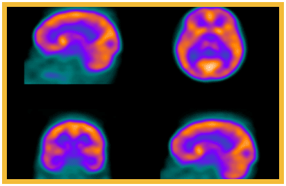 Nuclear Medicine Benchmark