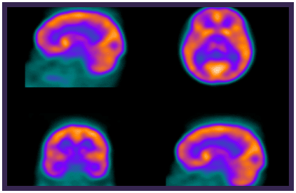 Nuclear Medicine Market Summary